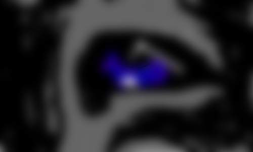 Wolf's Eye