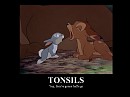 Tonsils